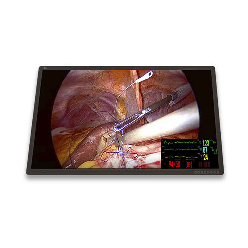Monitor medico - FM-C5501DV - FSN Medical Technologies - chirurgico / 3840 × 2160 / 55"