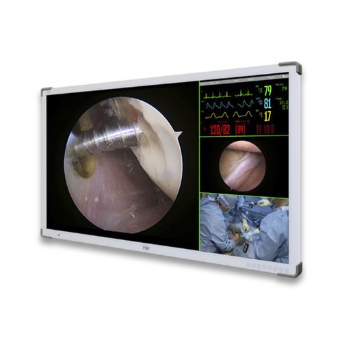 Monitor chirurgico - FSN Medical Technologies - per sala operatoria / diagnostico / medico