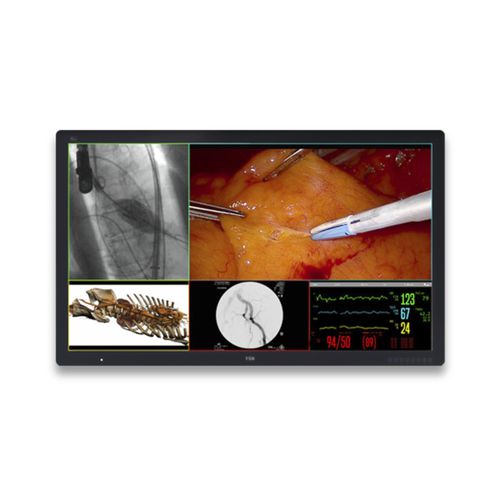 Monitor medico - FM-D5802DV - FSN Medical Technologies - chirurgico / per diagnostica per immagini / diagnostico