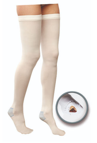 Calze antitrombo autoreggenti di prevenzione delle tromboembolie venose (TEV) - Thrombosis/PostOp - Gloria Med - per donna / M / L