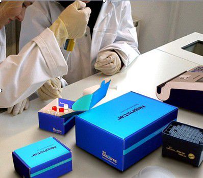 Reagente multifunzione - Nephstar  - Goldsite Diagnostics Inc. - di proteine / IgA / d'IgG