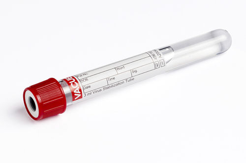 Provetta per prelievi da laboratorio - 456161 - Greiner Bio-One  - cilindrico / nasofaringeo / fluido orale
