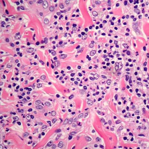 Reagente colorante - Eosin Y 1% alcoholic solutions - Histo-Line Laboratories - per istologia / liquido