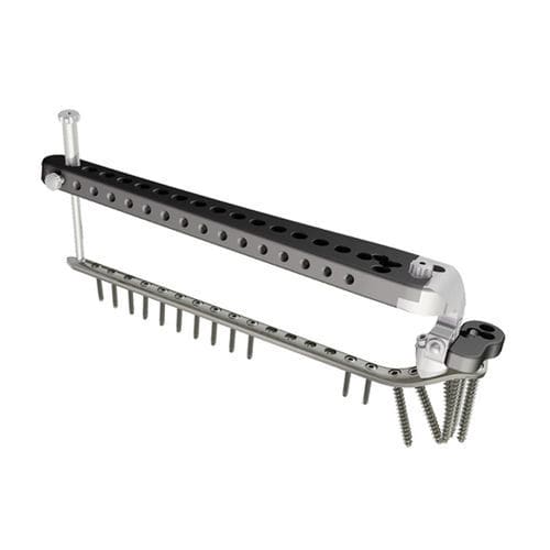 Placca di compressione per tibia - PTL - I.T.S.   - prossimale / laterale / bloccata