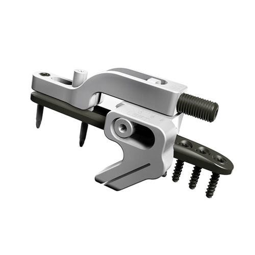 Placca per osteotomia per ulna - UOL 2 - I.T.S.   - distale / bloccata / in metallo