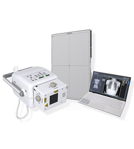 Sistema di radiografia digitale - Home Ray - IBIS X Ray Systems - per radiografia multidisciplinare / senza tavolo / portatile
