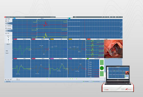 Software di controllo - NEX2019 - inomed Medizintechnik - di monitoraggio / di misura / di sicurezza