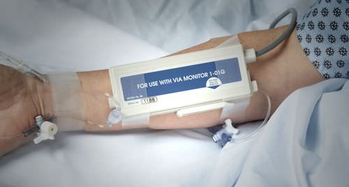 Glucometro CGM - GlucoScout® - International Biomedical 