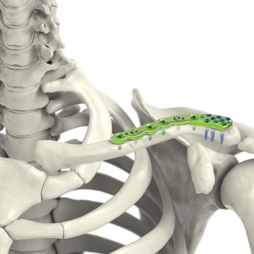 Placca di compressione per clavicola - Jeil Medical Corporation - laterale / mediale / bloccata