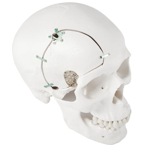 Sistema di fissazione cranica non assorbibile - LeForte Neuro 0.3 - Jeil Medical Corporation