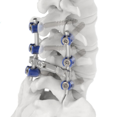 Sistema di osteosintesi lombare - Jeil Medical Corporation - via posteriore / per adulti