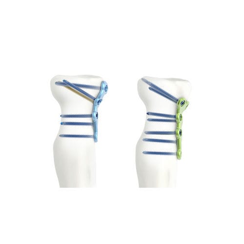 Placca di compressione per capo radiale - ARIX 2.0 - Jeil Medical Corporation - prossimale / bloccata / in titanio