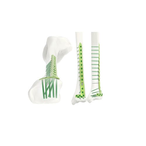 Placca di compressione per tibia - Jeil Medical Corporation - distale / bloccata / in titanio