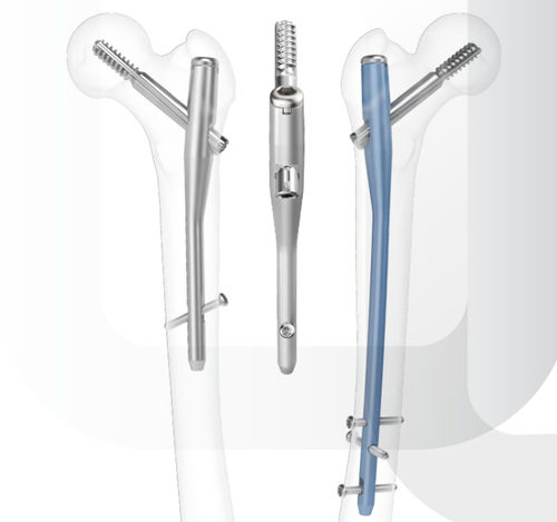 Chiodo intramidollare per femore - ARIX - Jeil Medical Corporation - fissazione prossimale / fissazione diafisaria / destro
