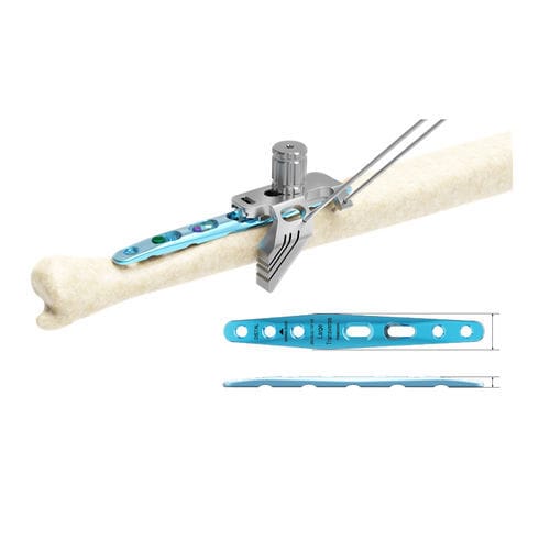 Placca per osteotomia per ulna - ARIX 2.8 - Jeil Medical Corporation - mediale / bloccata / in titanio