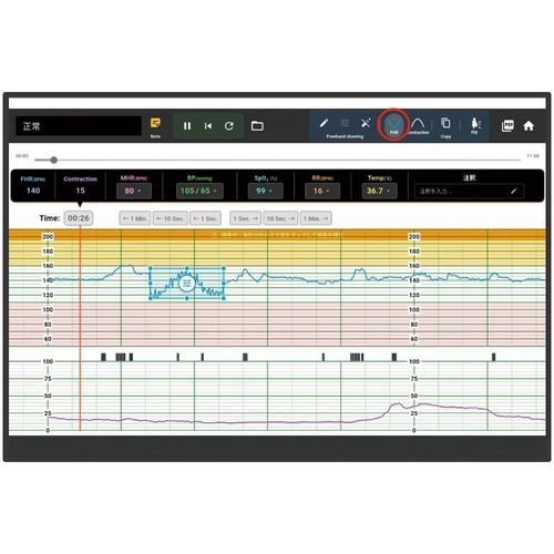 Simulatore per monitor fetali - KKG-5 - Kyoto Kagaku  - trattamento materno/neonatale / di cardiotocografia / di monitoraggio