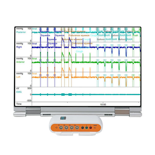 Monitor portatile per paziente - Solar™ Go  - Laborie Medical Technologies - per manometria / per terapia intensiva / per adulti