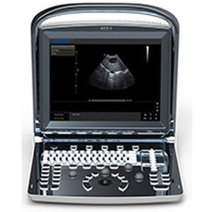 Ecografo portatile - Eco 3 - Medgyn Products - per ecografia ginecologica ed ostetrica / in bianco e nero / con console integrata