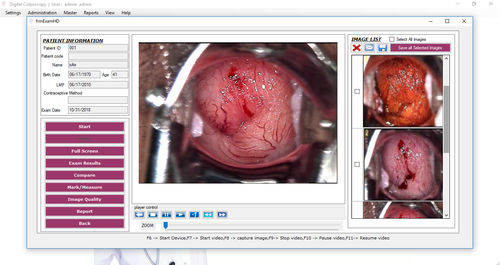 Sistema di gestione e analisi dati del paziente - 01047 series - Medgyn Products - di visualizzazione / di analisi / per reportistica