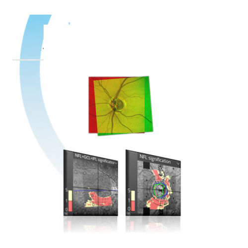 Software per ospedale - iTracking™ - Optopol Technology - per angiografia / per oftalmologia / di analisi