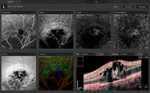 Modulo software per angiografia - Optopol Technology - per oftalmologia / di misura / di visualizzazione