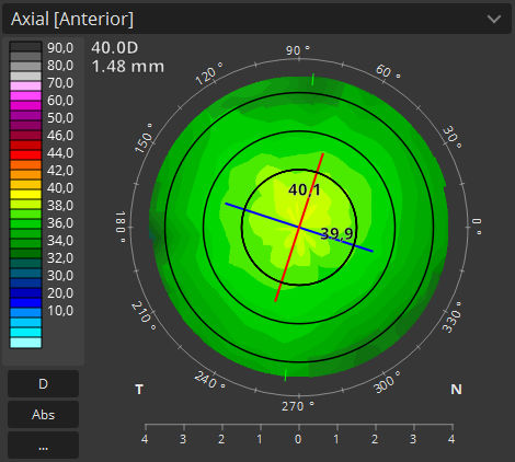 Modulo software per oftalmologia - T-OCT™ - Optopol Technology - di analisi / di acquisizione / di cornea