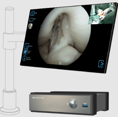 Videoregistratore per chirurgia - MVR 4K  - MediCapture - medico / 4K / compatto