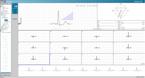 Software per ECG - Medset Medizintechnik  - di analisi / di misura