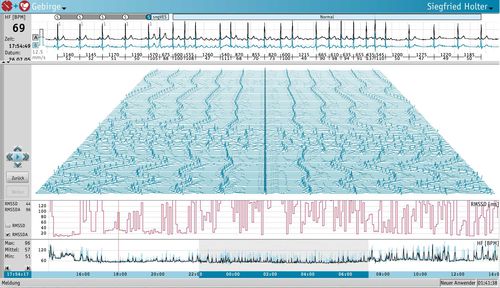 Software per Holter cardiaco - Medset Medizintechnik  - di analisi / di monitoraggio