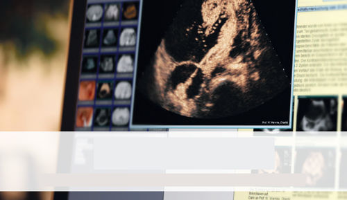 Software per reportistica - SonoWin&reg; - MESO - ospedaliero / per ambulatorio / per cartelle cliniche elettroniche