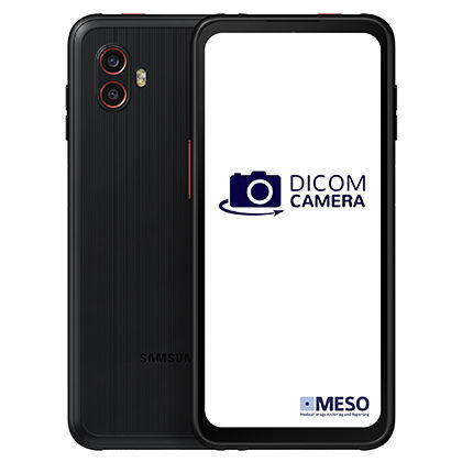 Fotocamera per dermatoscopio - DICOM Camera Compact - MESO - digitale / Full HD / CMOS