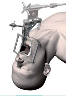Faringoscopio per adulti - Satou - Nagashima Medical Instruments - ad angolo retto