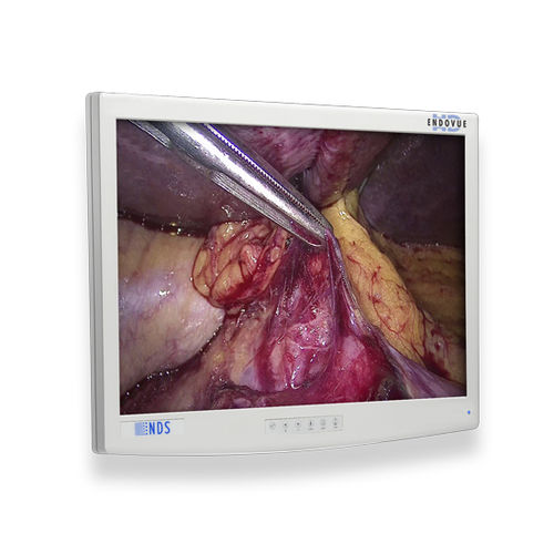 Monitor medico - EndoVue®  - NDS Surgical Imaging - per diagnostica per immagini / per endoscopia / chirurgico
