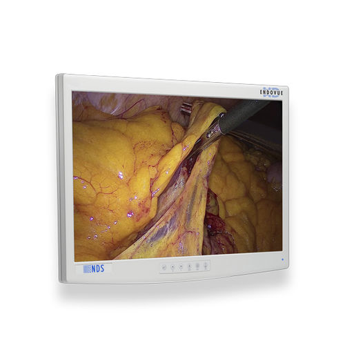 Monitor medico - EndoVue®  - NDS Surgical Imaging - per diagnostica per immagini / per endoscopia / chirurgico