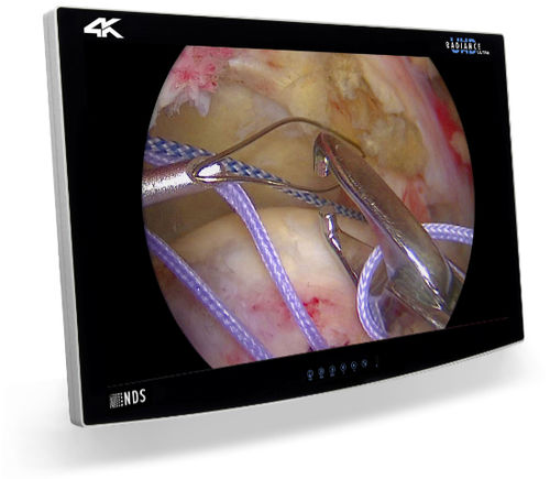 Monitor per endoscopia - RADIANCE® ULTRA - NDS Surgical Imaging - 4K / HD / 32"