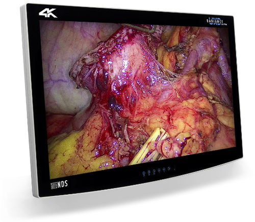 Monitor medico - RADIANCE® ULTRA - NDS Surgical Imaging - chirurgico / 4K / 32"