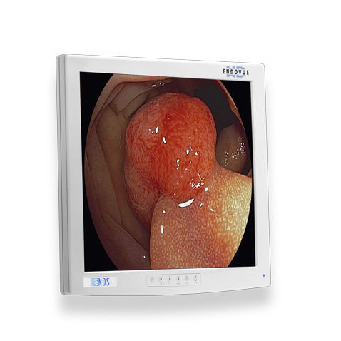 Monitor medico - ENDOVUE® - NDS Surgical Imaging - per diagnostica per immagini / per endoscopia / ad alta definizione