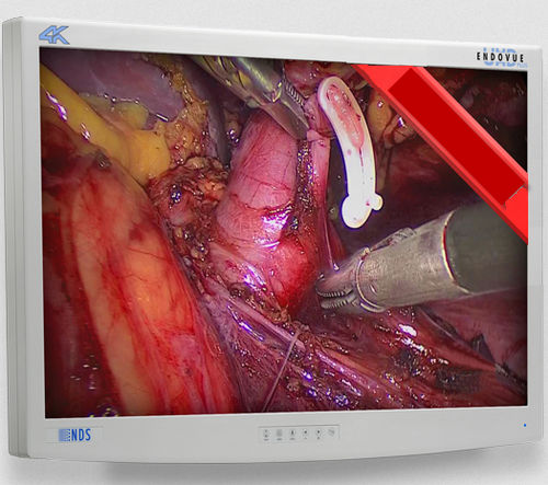 Monitor medico - EndoVue Plus  - NDS Surgical Imaging - per endoscopia / ad alta definizione / 32"