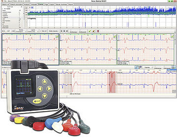 Software di analisi - NH-301 - NORAV Medical - diagnostico / di monitoraggio / di registrazione