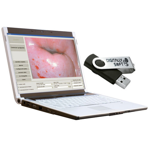 Software medico - DIGITALLY SOFT - OPTOMIC - ginecologia / di gestione dei referti dei pazienti / di controllo