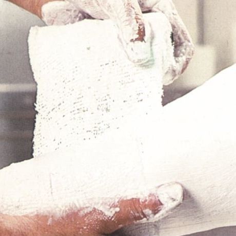Benda gessata - Pharma-POP® - Pharmaplast