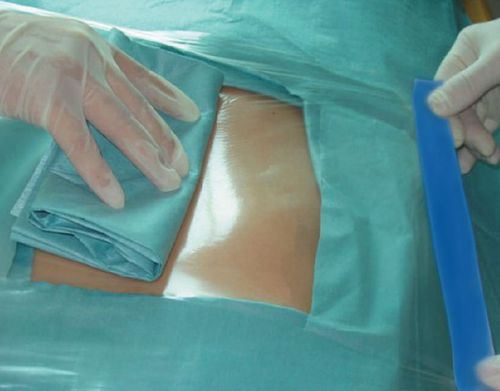 Telo chiurgico per chirurgia generale - Incifilm® - Pharmaplast - per chirurgia ortopedica / per cardiochirurgia / per chirurgia oftalmica