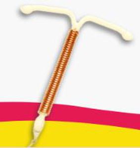 Dispositivo intrauterino copper-T - Silverline Cu 380 Ag mini - Pregna International