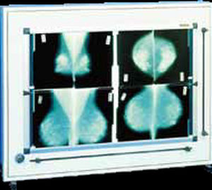 Negativoscopio 2 corpi - DXHM 72 x 46 - PrimaX Berlin - con interruttore / per mammografia / a tendina