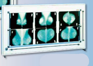 Negativoscopio 3 corpi - DXHM 105 x 46 - PrimaX Berlin - con interruttore / per mammografia / a tendina