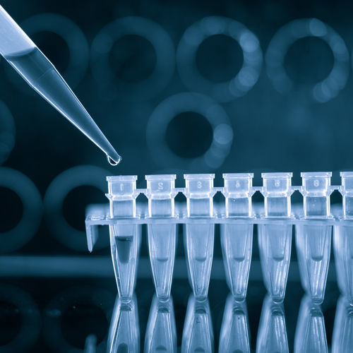 Kit di test per malattie veneree - QP10704 - Randox Laboratories - del Neisseria gonorrhea / della Chlamydia trachomatis / per Rt-qPCR