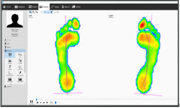 Software per podologia - v9 Essentials - Materialise - di analisi / di misura / di condivisione
