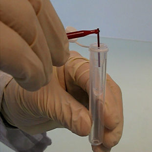 Kit di reagenti in soluzione - PN 2015 - Sebia  - diagnostico / del diabete / da laboratorio