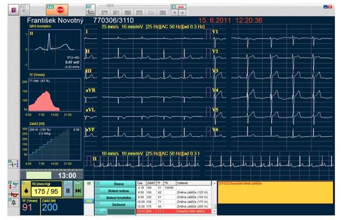 Modulo software per elettrocardiografia - SEIVA Ergolog - Seiva - per prova da sforzo / di gestione dati / di registrazione