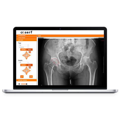 Software di pianificazione - SERF - ortopedico / per tablet PC